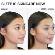 Afterglow - Collagen Infused Mouth Tape